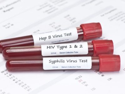About HIV and STD Testing Singapore