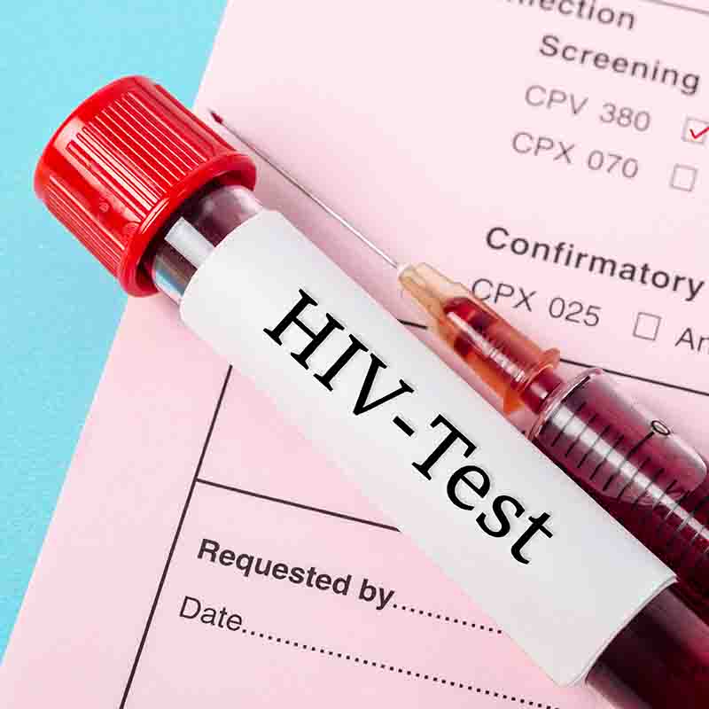hiv and std testing singapore